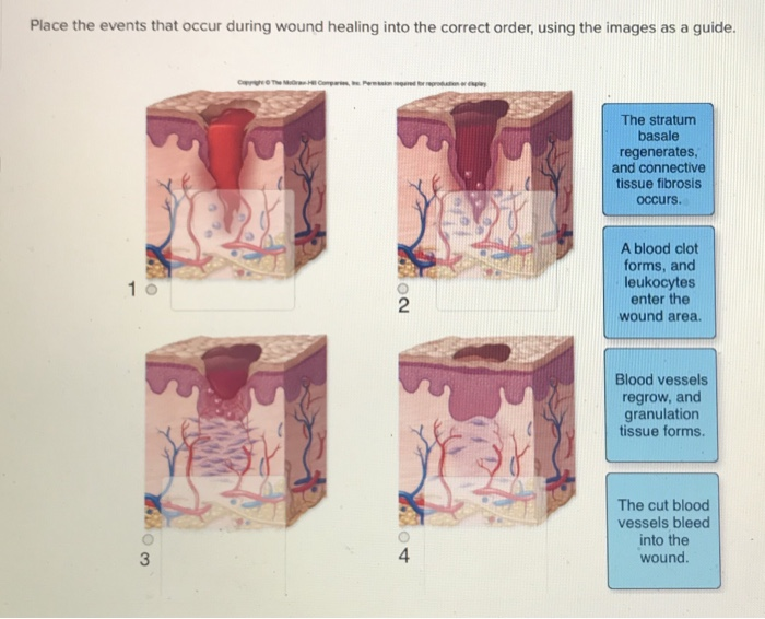 Solved Place the events that occur during wound healing into