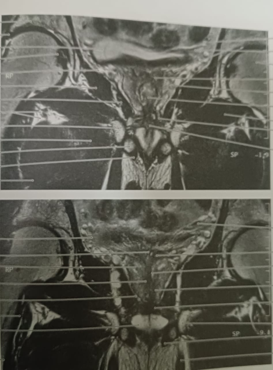 Mri Labelling Pages Please Skip the question if you dont know the | Chegg.com