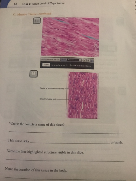 Solved 26 Unit 2 Tissue Level of Organization C. Muscle | Chegg.com