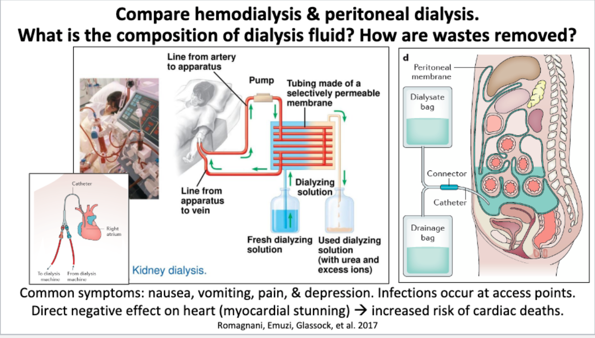 peritoneal dialysis diagram