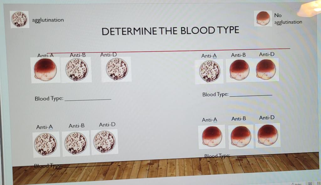 agglutination
DETERMINE THE BLOOD TYPE
Blood Type:
Blood Type:
Anti-A Anti-B Anti-D