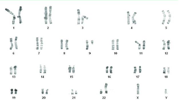 Solved Below is a selection of karyotypes showing | Chegg.com