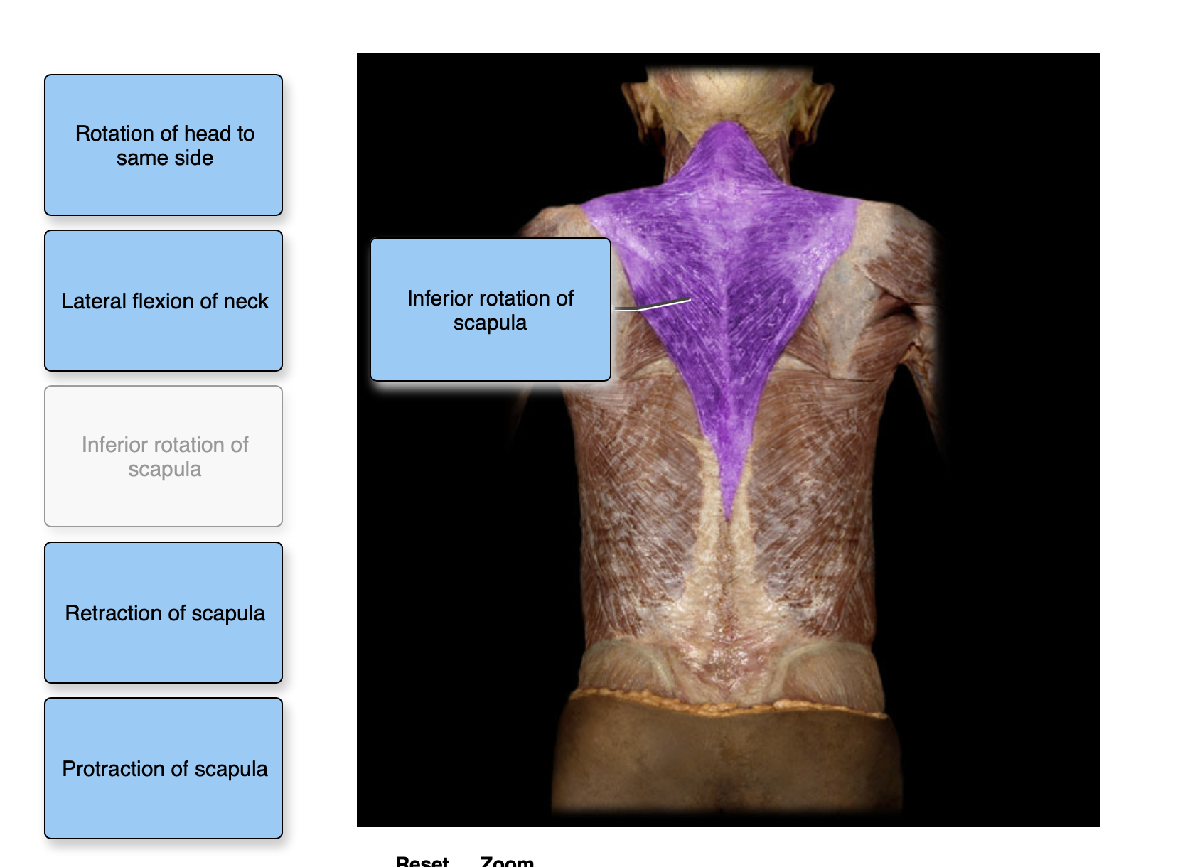 Solved Rotation of head to same side Lateral flexion of neck | Chegg.com