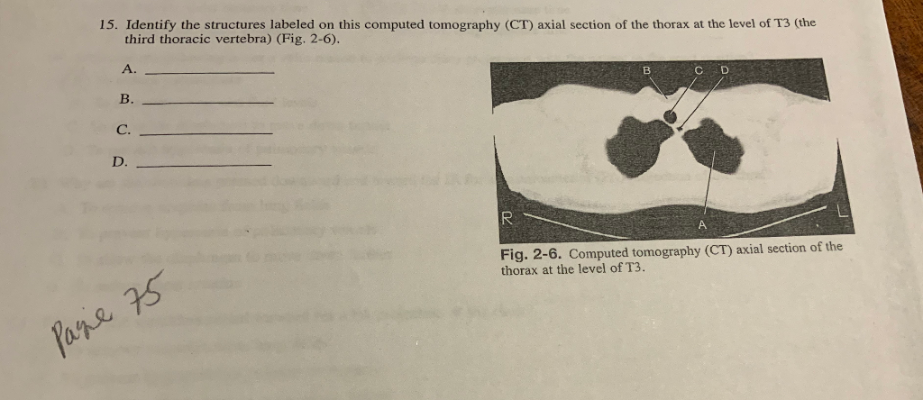 Solved 15. Identify the structures labeled on this computed | Chegg.com