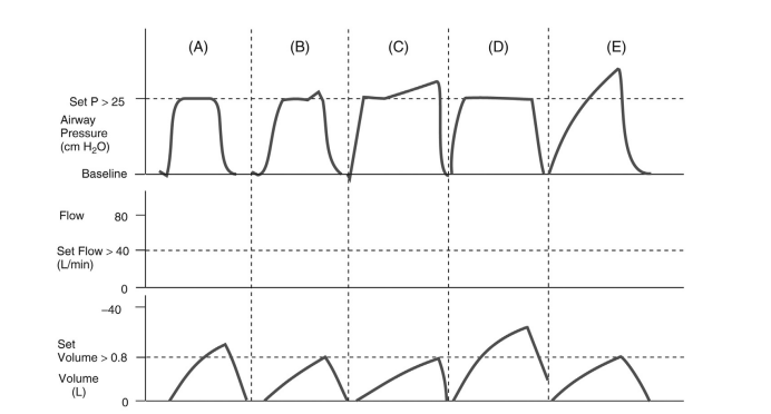 Solved Sketch the corresponding flow waveforms for the | Chegg.com