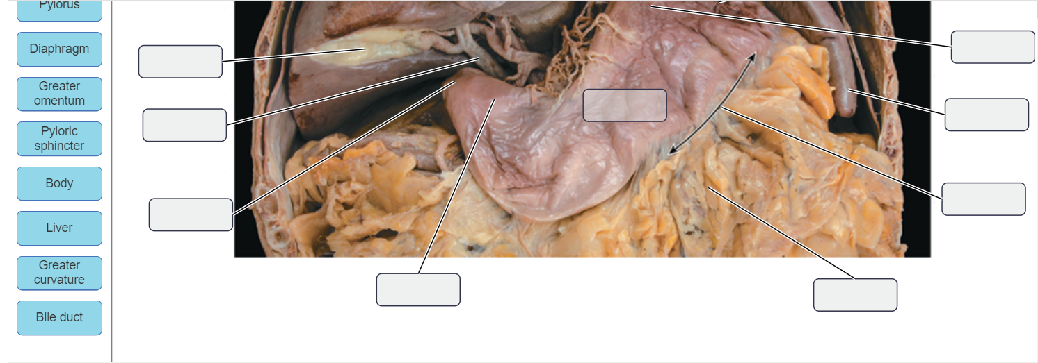 Ch 23 Lab Item 4 4 Of 5 Part A Surface Anatomy Chegg Com