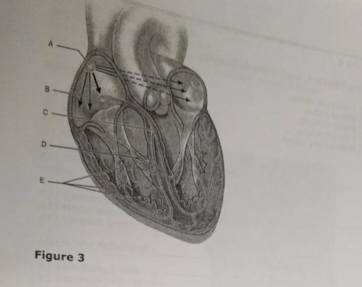 Solved Figure 2 Using Figure 2, Match The Following: 15) | Chegg.com