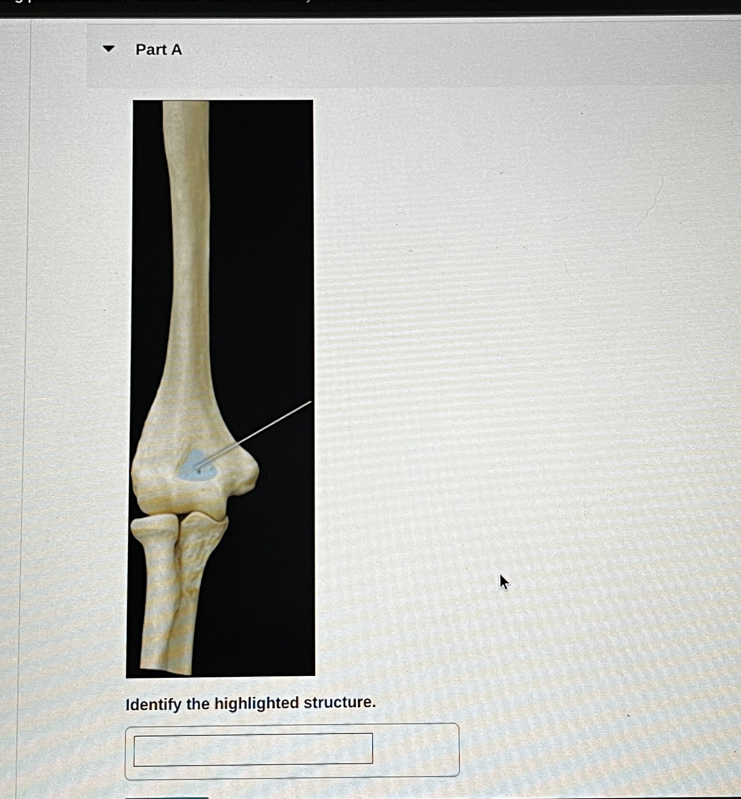 Solved Part AIdentify the highlighted structure. | Chegg.com