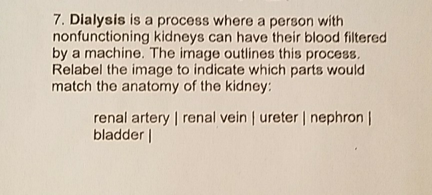 Solved 7. Dialysis is a process where a person with | Chegg.com