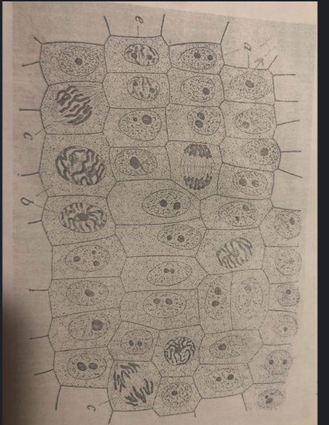 Solved identify cells in the interphase, prophase, | Chegg.com