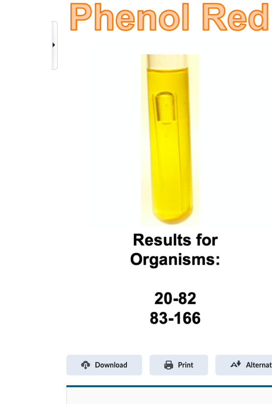 Solved Record the results and interpretations for both