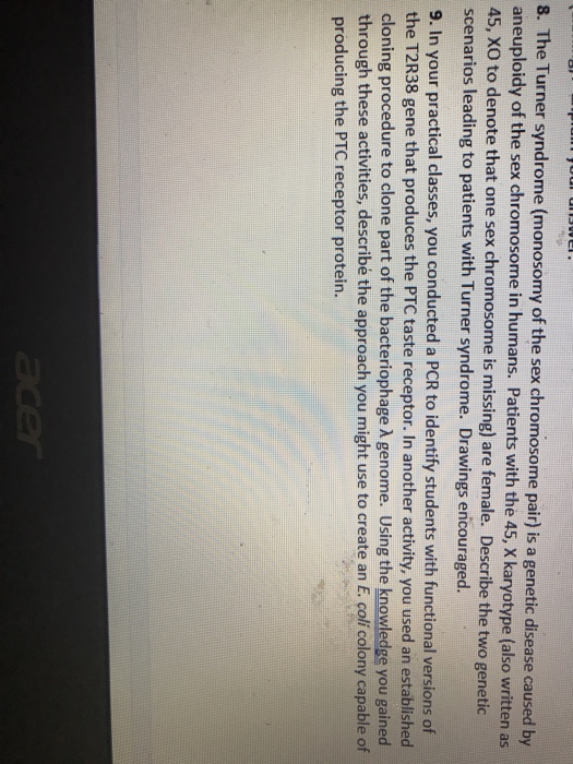 Solved Turner syndrome (monosomy of the sex chromosome pair)