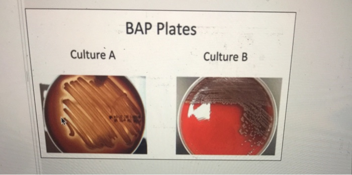 Solved BAP Plates Culture A Culture B | Chegg.com