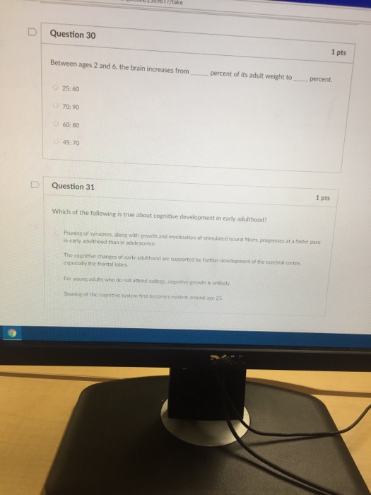 Solved Question 30 1 pts Between ages 2 and 6, the brain | Chegg.com