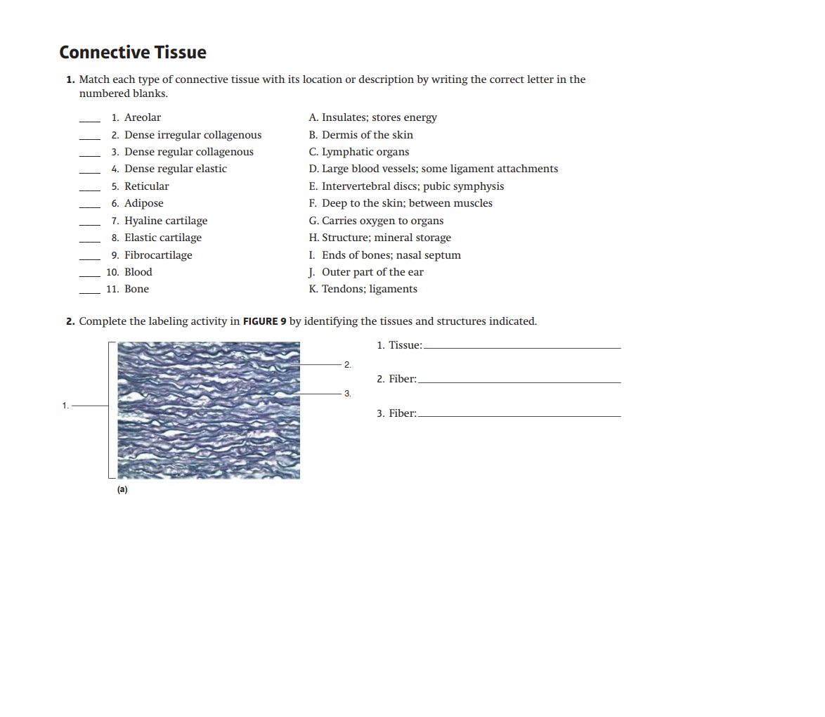 Solved match each type of connective tissue with its