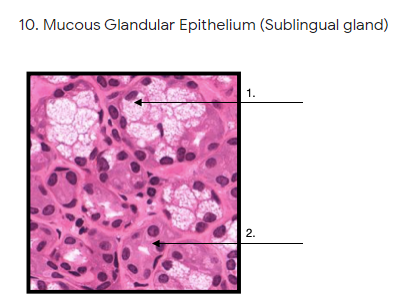 Solved 10. Mucous Glandular Epithelium (Sublingual gland) 1. | Chegg.com