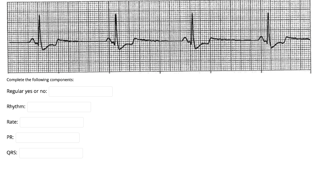 Complete the following components: Regular yes or no: Rhythm: Rate: PR: QRS: