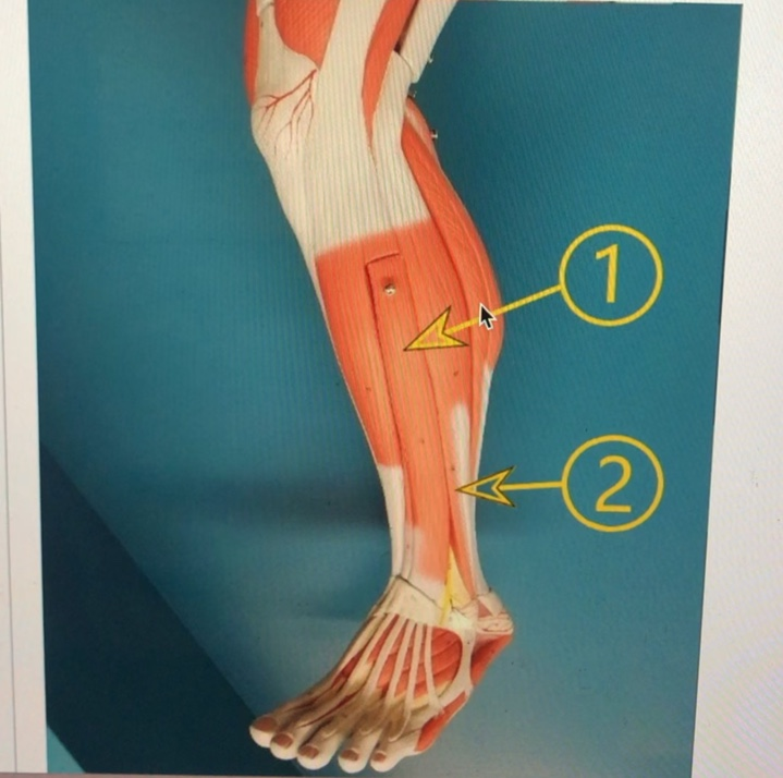 Solved what is the insertion of # 1? 1) digital phalanx of | Chegg.com