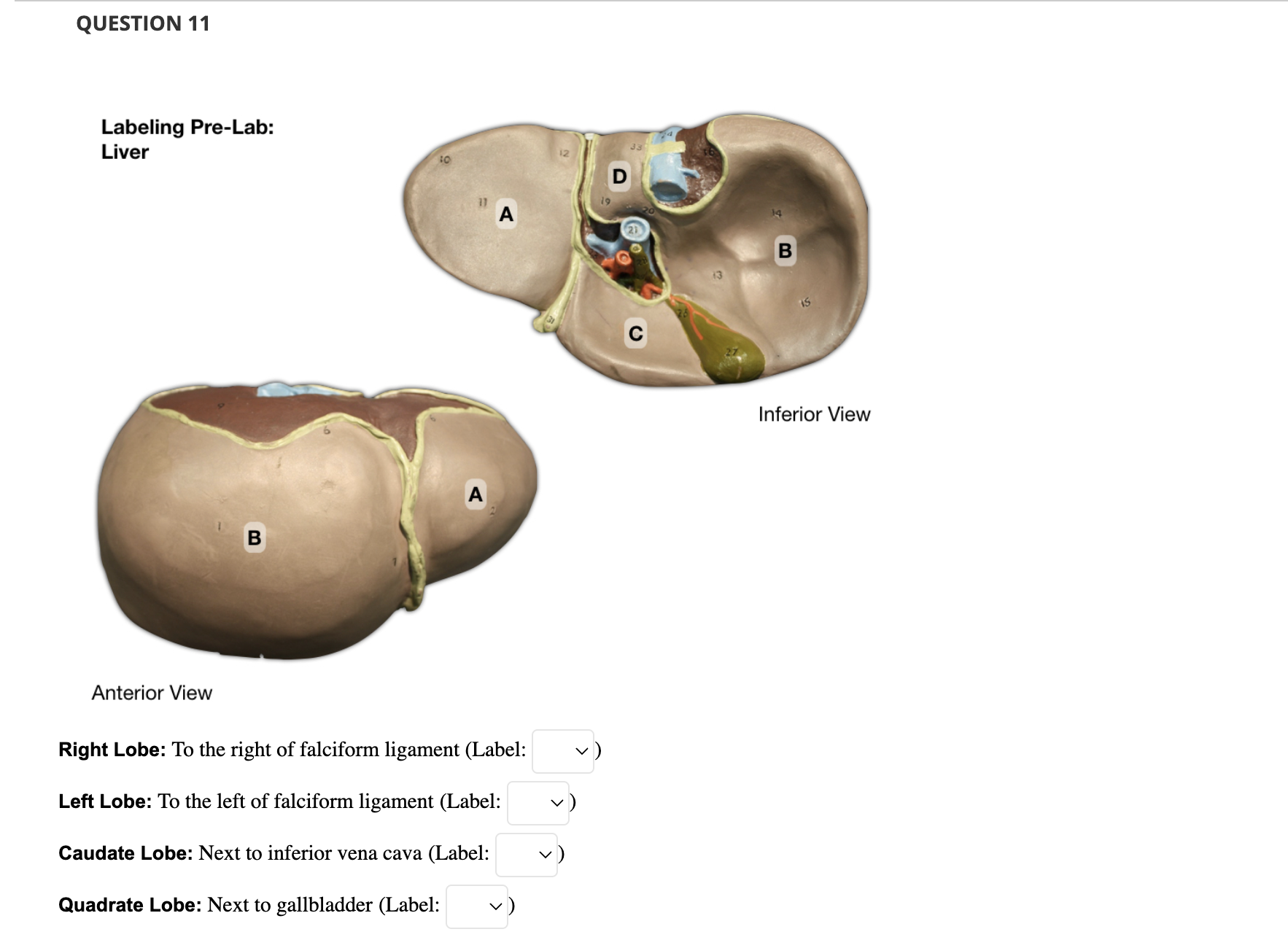 Solved Labeling Pre-Lab: Large Intestine J Anterior View | Chegg.com