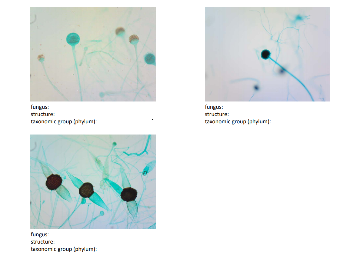 Solved Examine, draw and label the prepared slide of