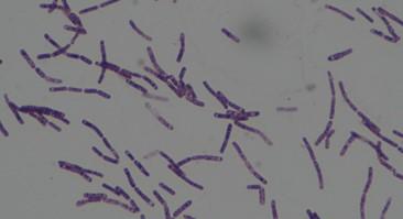 Solved Below are two photos. The top photo is Bacillus | Chegg.com