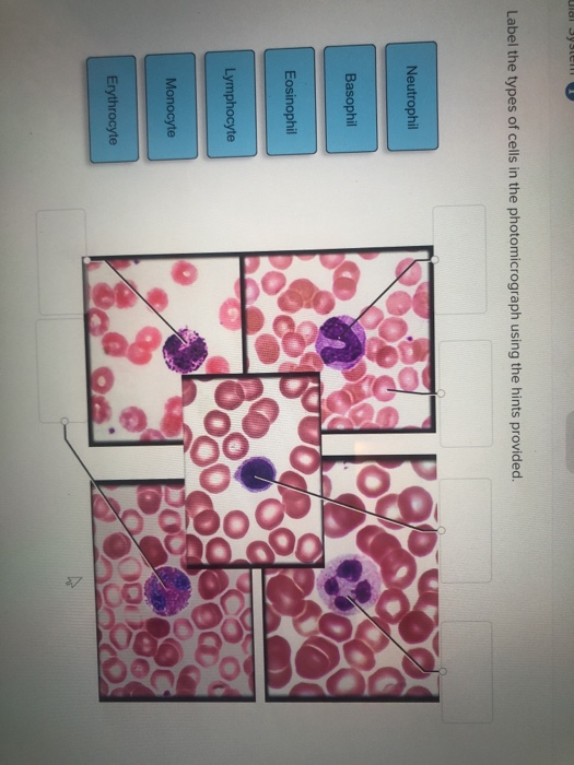 Label the Photomicrograph Using the Hints Provided.