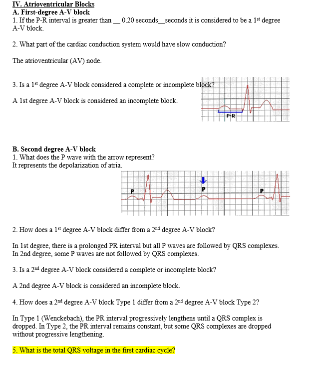 Solved IV. Atrioventricular Blocks A. Firstdegree AV block