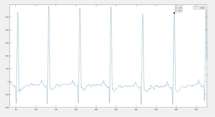 Solved Using the file in problem 2. Write a Matlab code that | Chegg.com