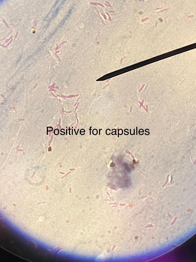 Solved 1 Negative acid-fast Positive for | Chegg.com