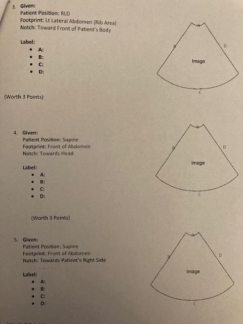 3. Given:
Patient Position: RLD
Footprint: Lt Lateral Abdomen (Rib Area)
Notch: Toward Front of Patients Body
Label:
- A:
- 