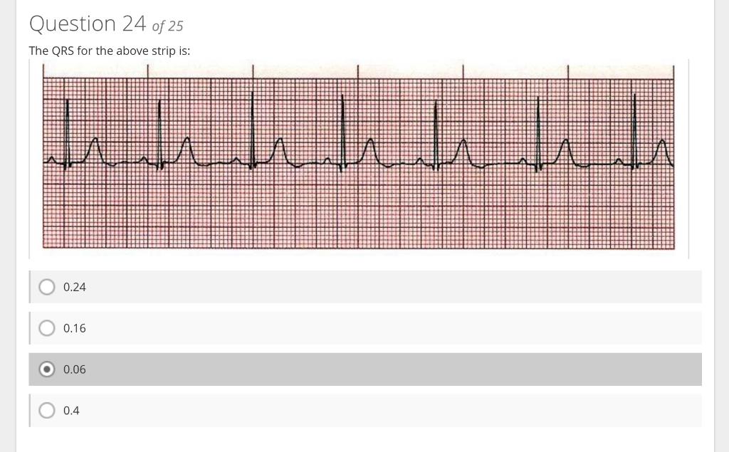 Question 24 of 25
The ORS for the above strio is:
\( 0.24 \)
\( 0.16 \)
\( 0.06 \)
\( 0.4 \)