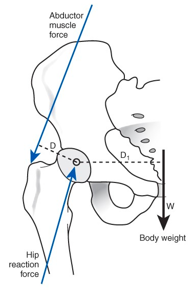 Solved Consider This Schematic Below Depicting Hip Loading 