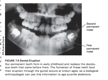 Solved at Second permanent molar s SPL/Science Souro First | Chegg.com