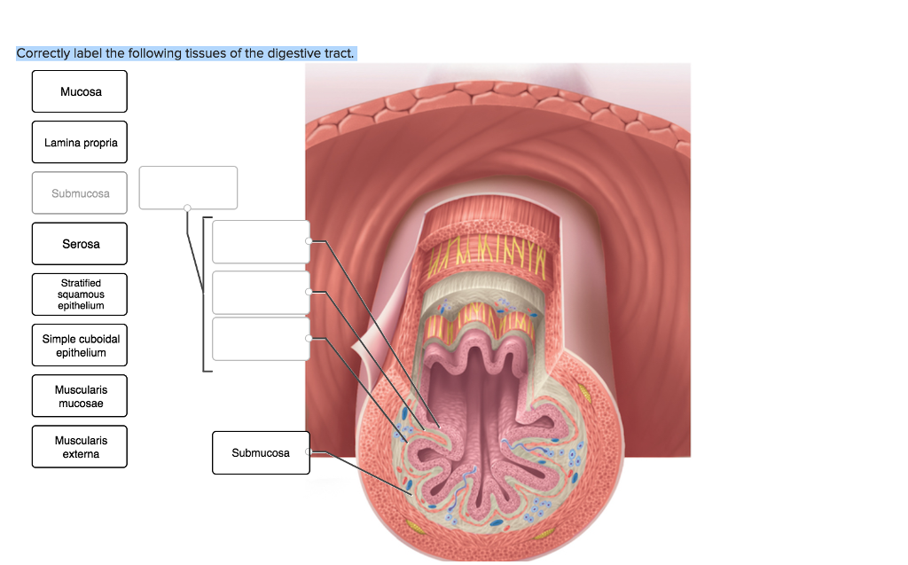 solved-correctly-label-the-following-tissues-of-the-chegg