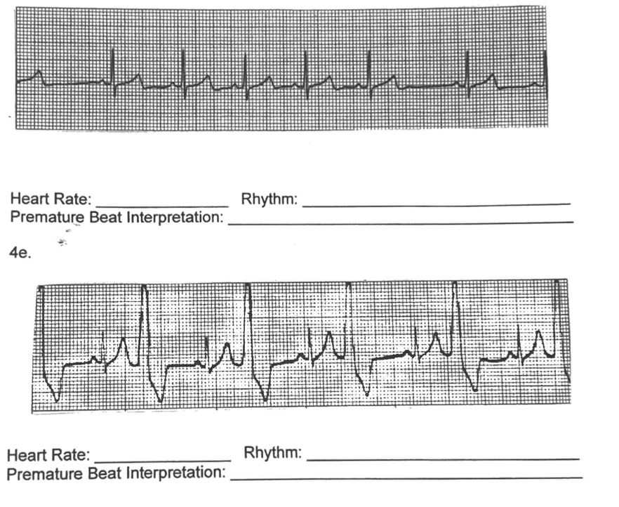 Solved for each of them, find the heart rate, rhythm, and | Chegg.com