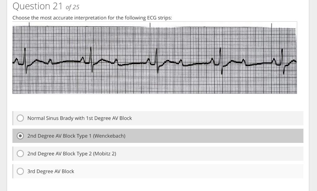 Choose the most accurate interoretation for the following ECG strios:
Normal Sinus Brady with 1st Degree AV Block
2nd Degree 