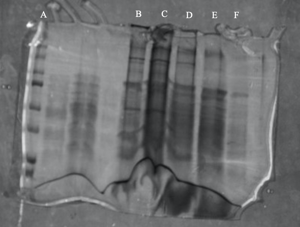 Please help analyze the SDS-PAGE gel image. I am | Chegg.com