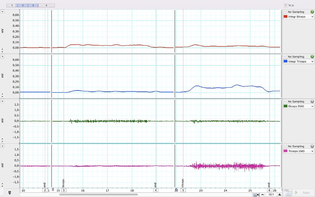 Solved 1 1 2 3 1k/ 0,60 No Sampling Integr Biceps 0,50 0.40- | Chegg.com