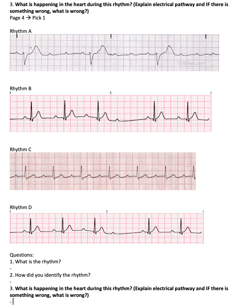 Solved 3. What is happening in the heart during this rhythm? | Chegg.com