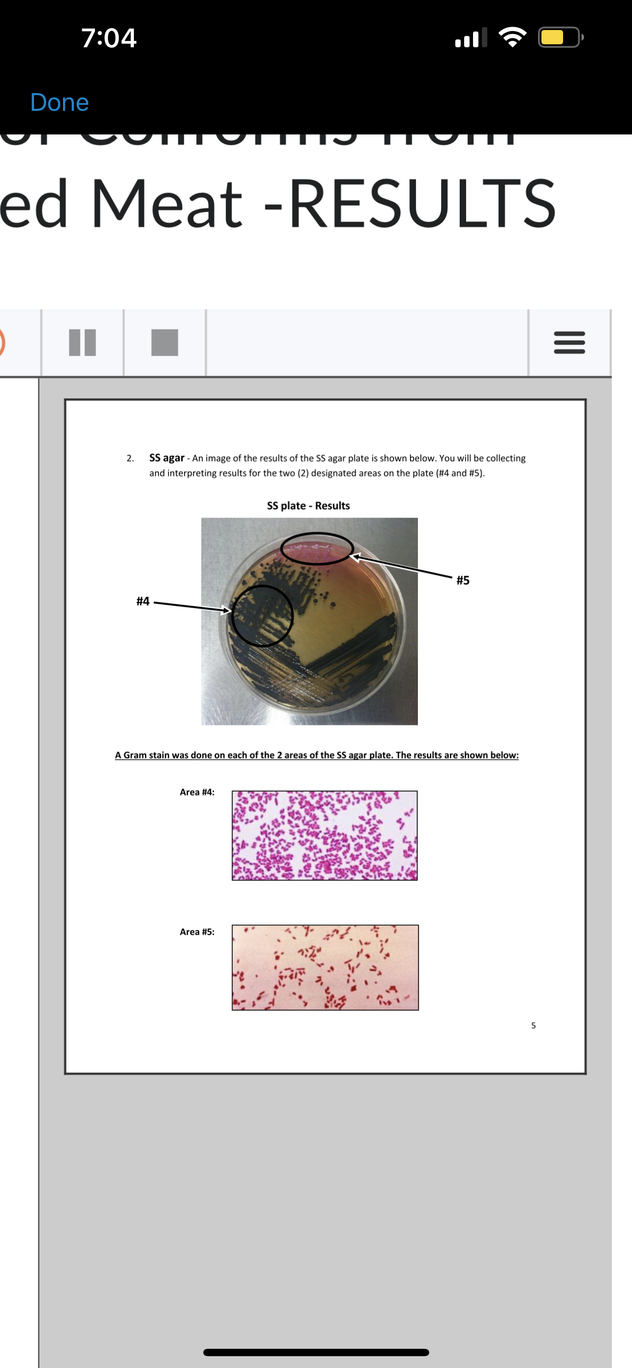 Solved SalmonellaShigella (SS) agar plate results and