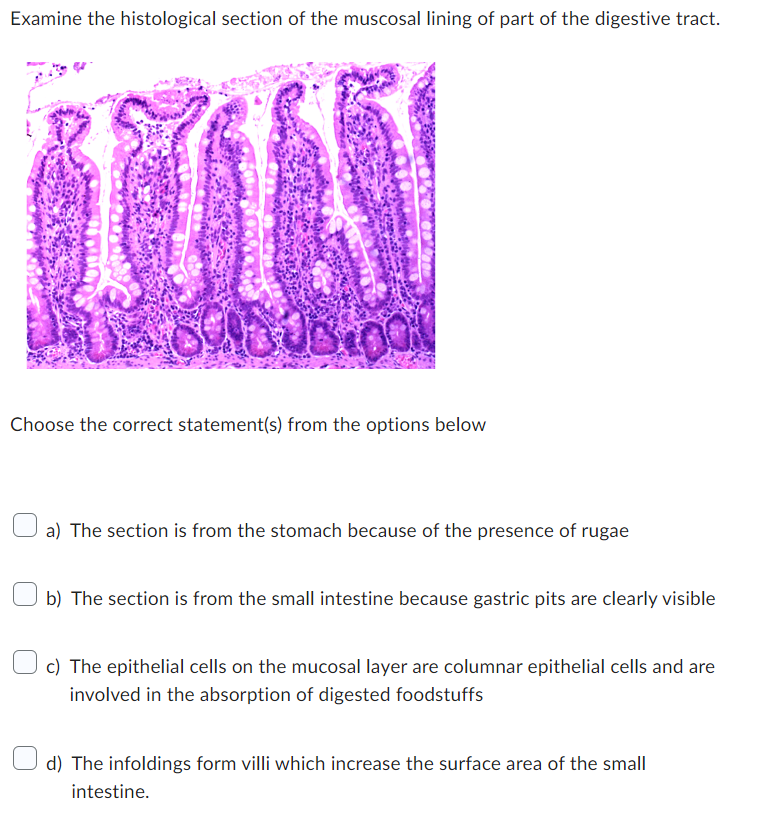 Examine the histological section of the muscosal lining of part of the digestive tract.
Choose the correct statement(s) from