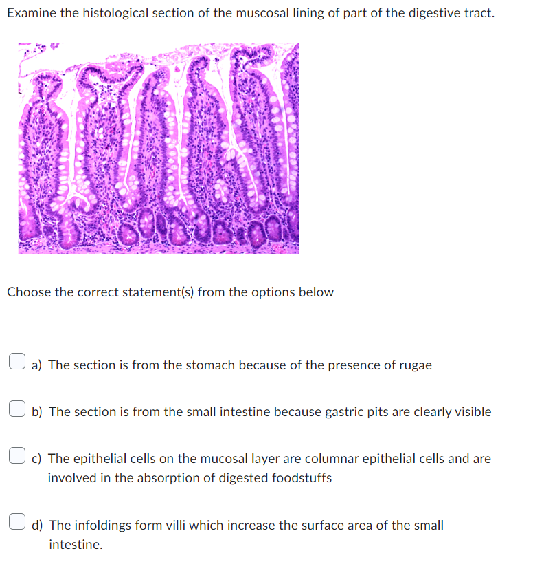 stomach rugae histology