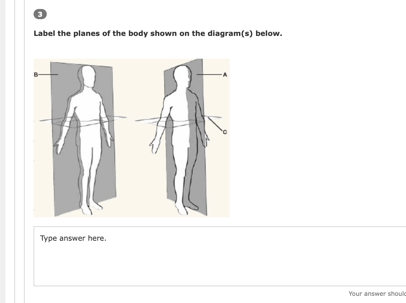 Solved 3 Label the planes of the body shown on the | Chegg.com
