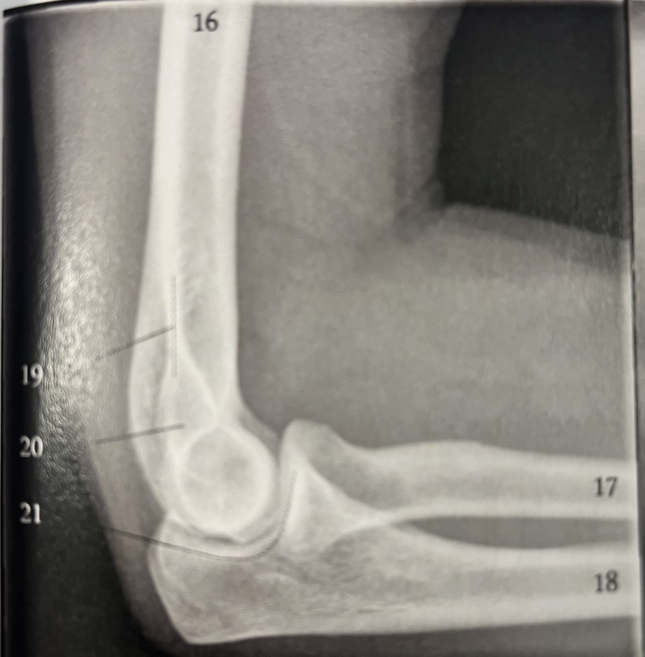 Solved for numbers 16 18 identify the bone indicated for chegg