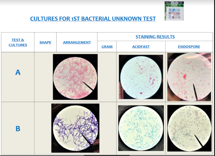 Solved Identify specimen A & B respectively with the