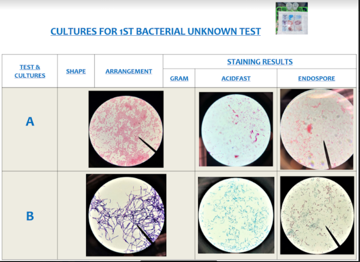 Solved Identify Specimen A & B Respectively With The | Chegg.com