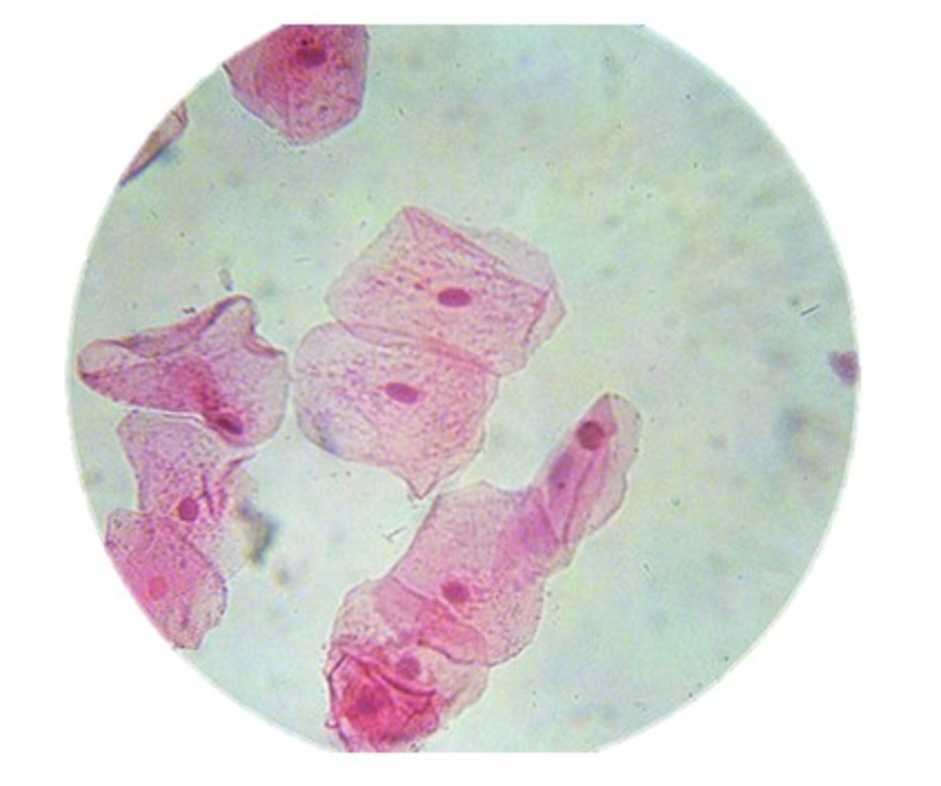 Solved These cells was microscope was at 400X total