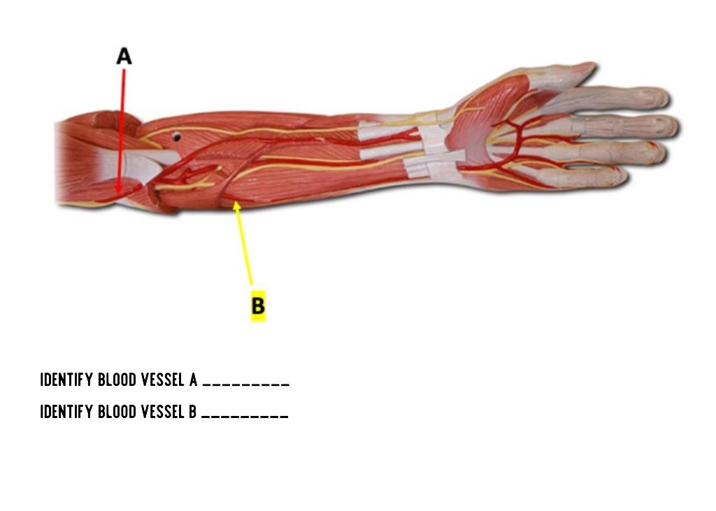 Solved A B IDENTIFY BLOOD VESSEL A IDENTIFY BLOOD VESSEL B | Chegg.com