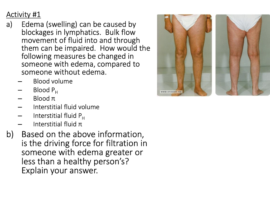 Edema Can Best Be Observed In Solved Activity #1 a) Edema (swelling) can be caused by | Chegg.com