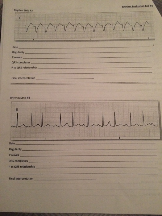 Solved Rhythm Evaluation Lab Note: In working to identify | Chegg.com